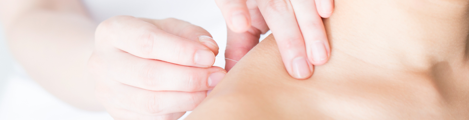 price_img01 | 渋谷中医メディカル鍼灸院 中医鍼灸コース(50分)