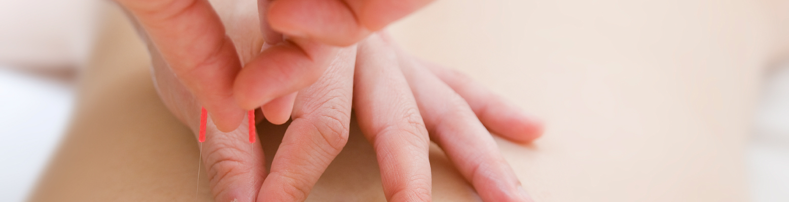 price_img01 | 渋谷中医メディカル鍼灸院 中医鍼灸コース(70分)