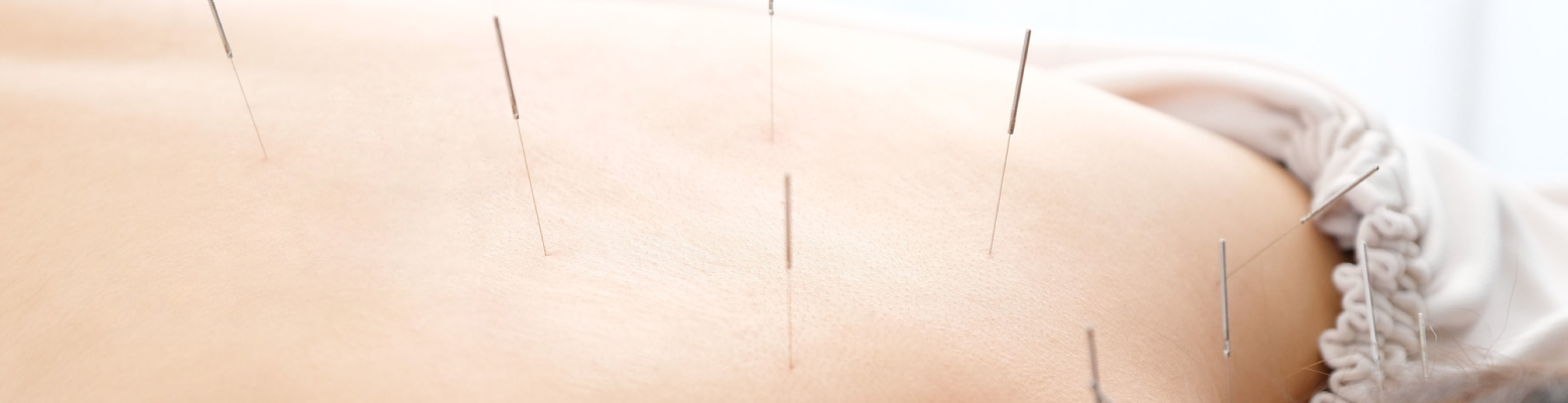 price_img01 | 渋谷中医メディカル鍼灸院 中医鍼灸コース(90分)