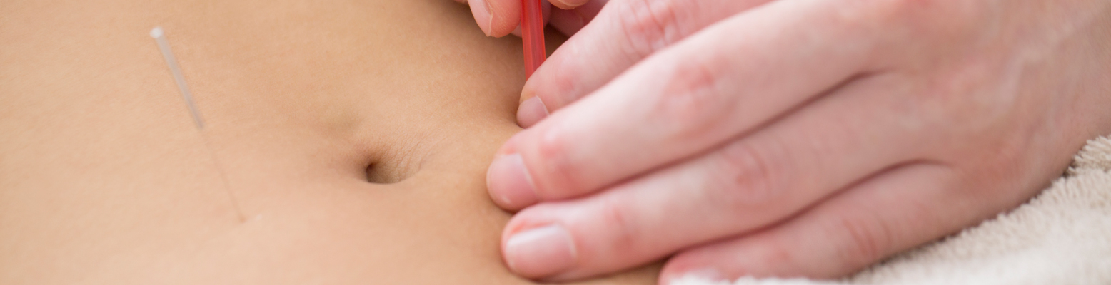 price_img01 | 渋谷中医メディカル鍼灸院 鍼灸減肥コース